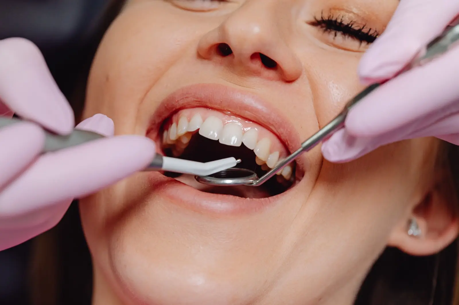 Dentist examining a patient's smile during a cosmetic dental assessment